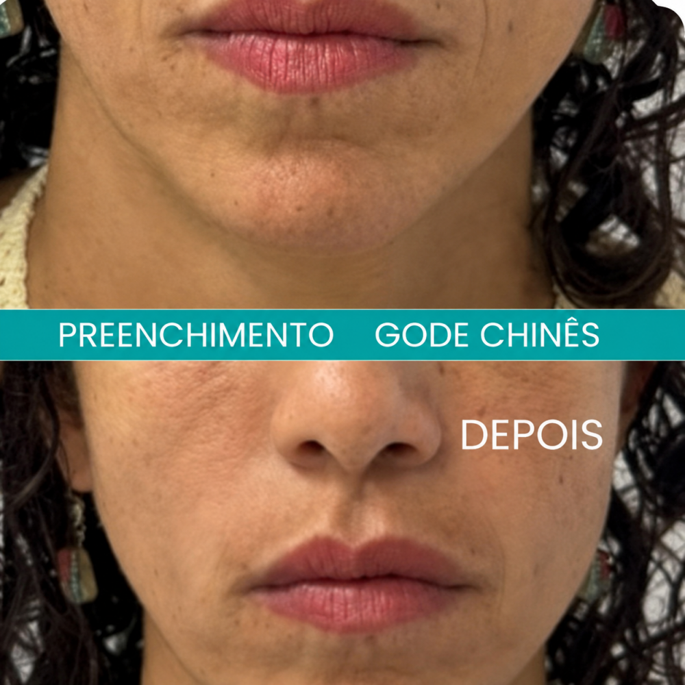 Bigode Chinês